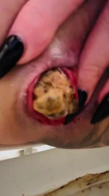 Look at that prolapse! [UltraHD 4K] 45.5 MB