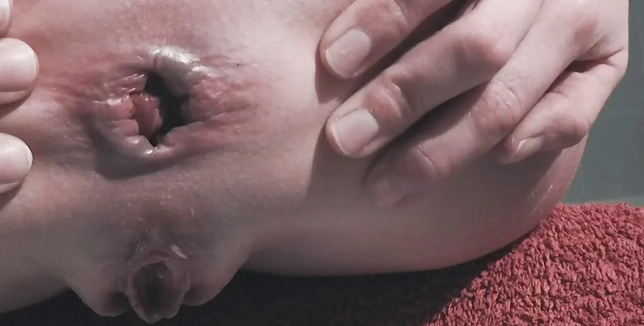 Close Shit With Prolapse - Femdom Scat - Toilet Slave - Copro - Extreme Porn Video on XXXExtreme